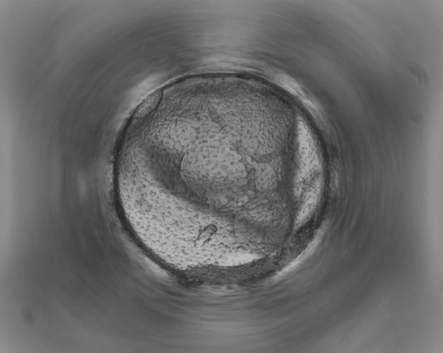 X0000111681459200908141440