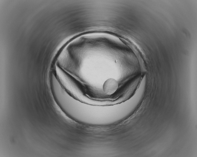 X0000111681468200908141440