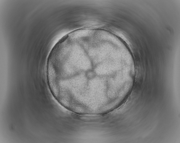 X0000111681487200908141439