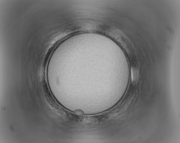 X0000111780579200908061116