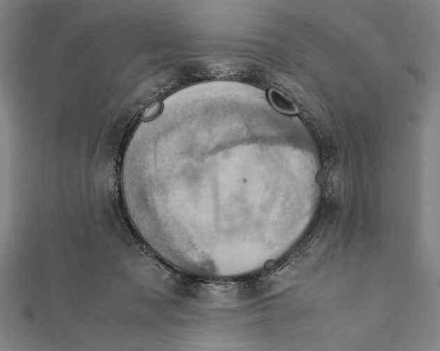 X0000111780317200908201115