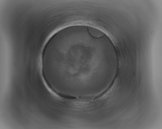 X0000111791515200907231132