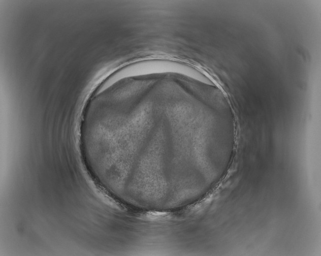 X0000111790055200908061145