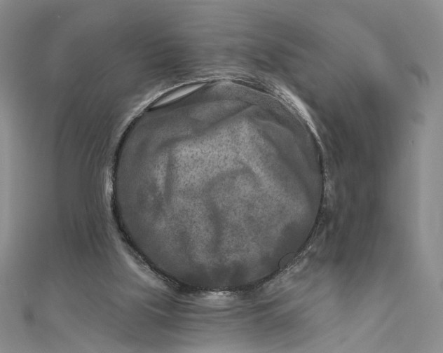 X0000111790059200908061145