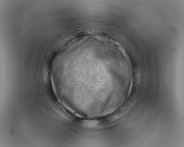 X0000111790266200908061143