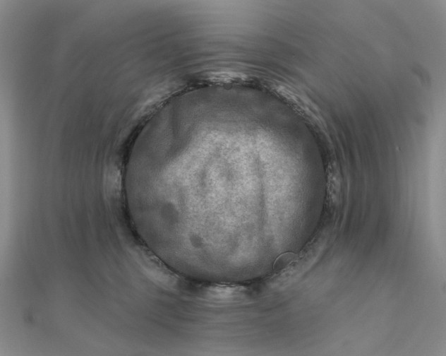 X0000111790375200908061142