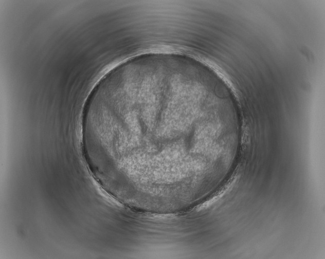 X0000111790837200908061135