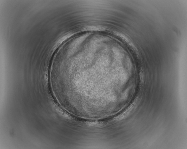 X0000111791025200908061132