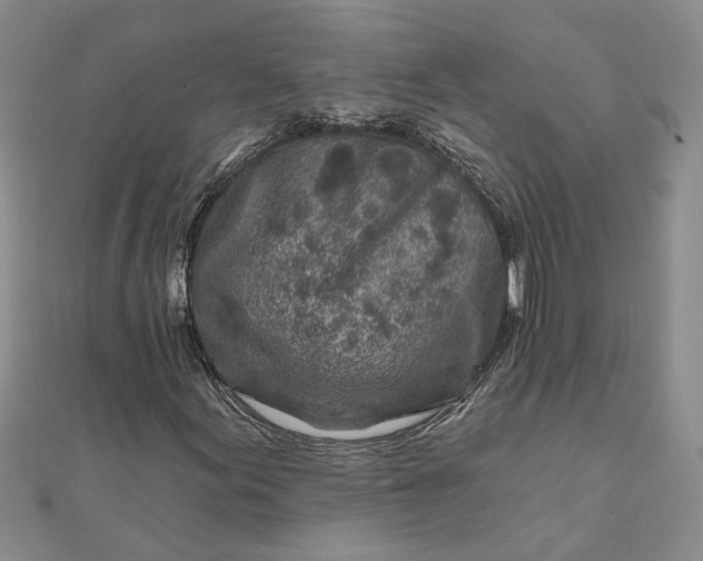 X0000111791155200908061131