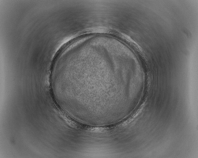 X0000111791166200908061130