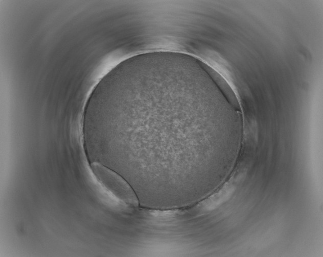 X0000111791389200908061127