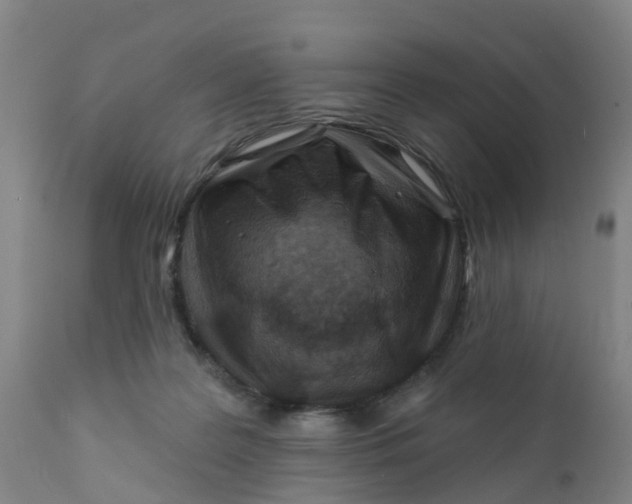 X0000111790219200908131420