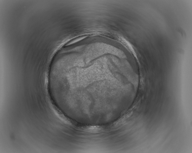 X0000111790059200908201140