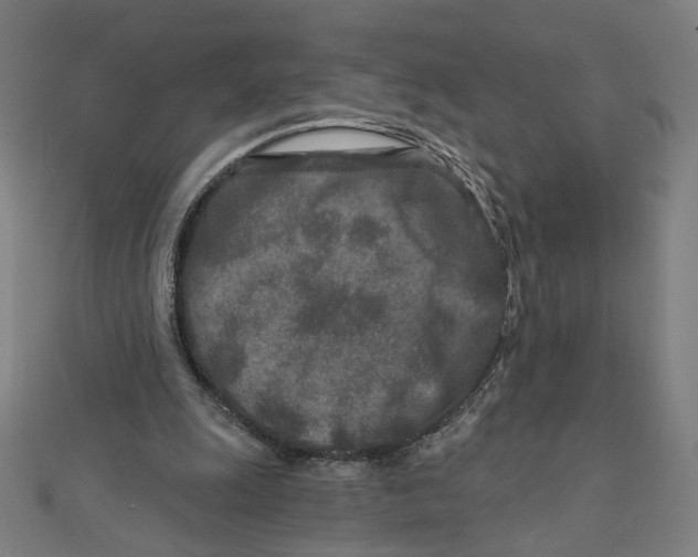 X0000111790247200908201138