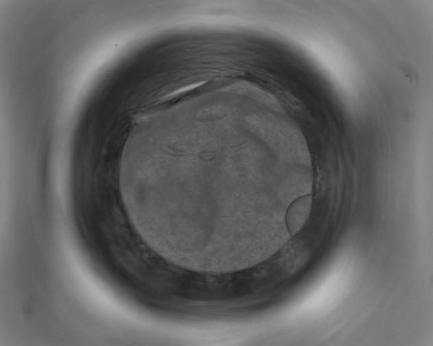 X0000111790383200908201137