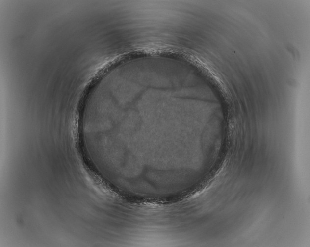 X0000111790592200908201133