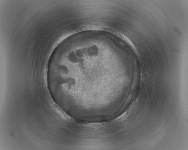 X0000111791035200908201127