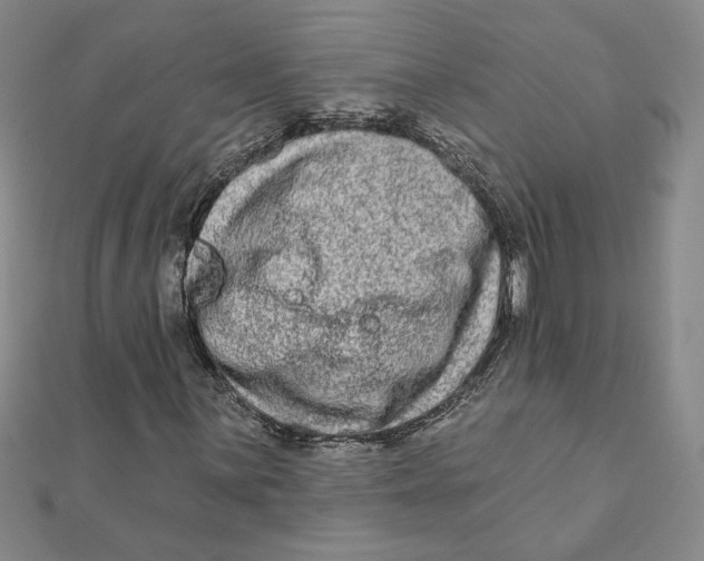 X0000111791059200908201127