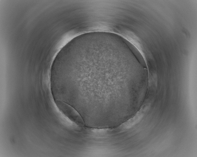 X0000111791389200908201122