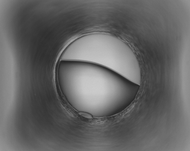 X0000111800148200907231002