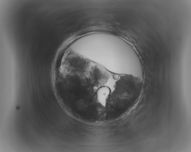 X0000111800149200907231002