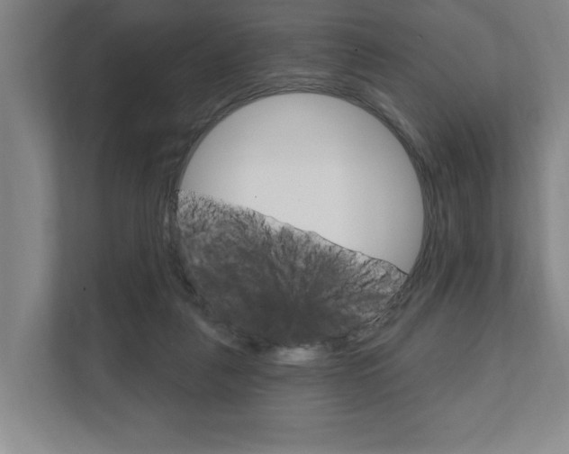 X0000111800259200907231001