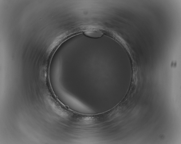 X0000111800059200907231220