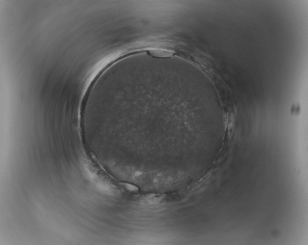 X0000111800148200907301217
