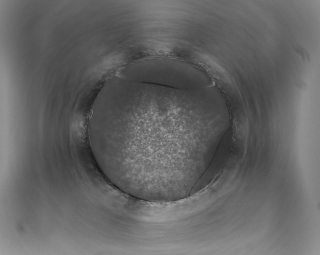 X0000111800037200908061207