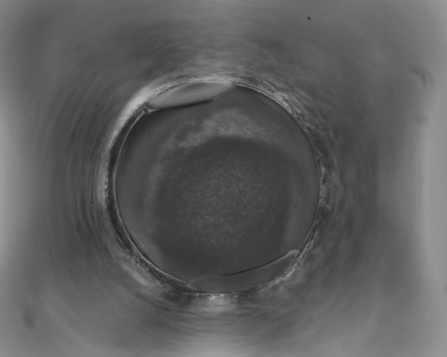 X0000111800056200908061207