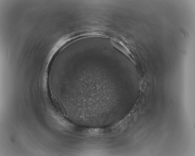 X0000111800152200908061206