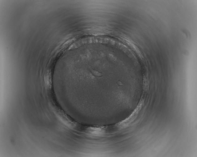 X0000111800170200908061206