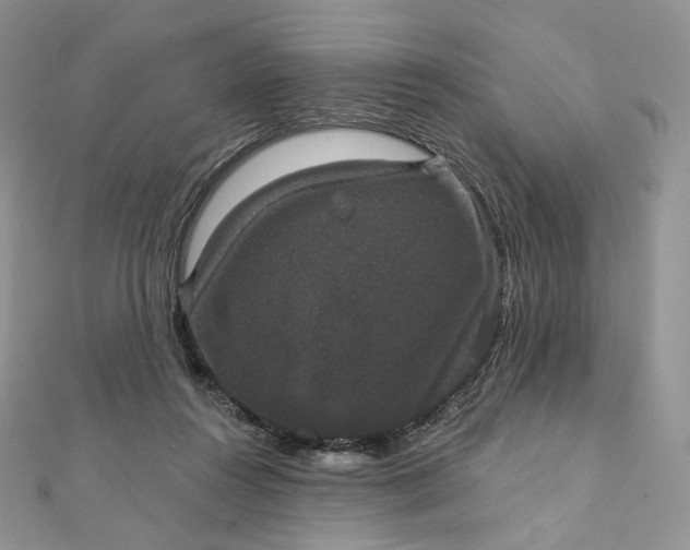 X0000111800360200908061203