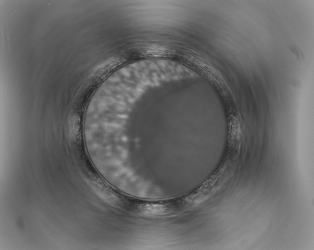 X0000111800361200908061203