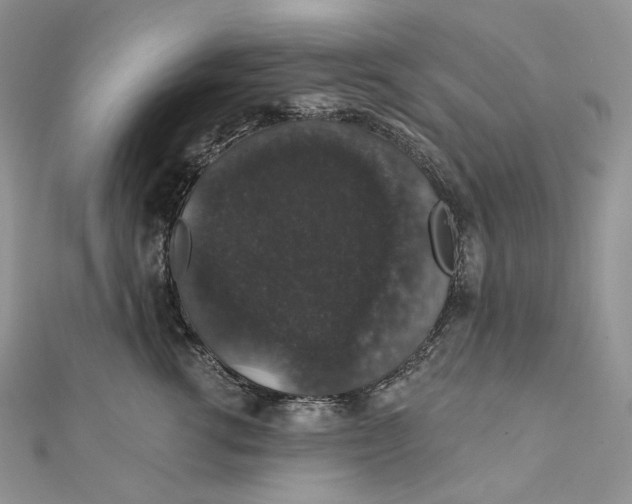 X0000111800762200908061158