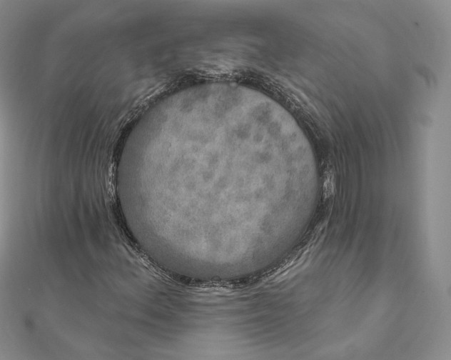 X0000111801156200908061152