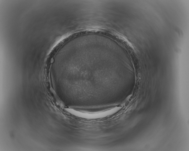 X0000111801256200908061150