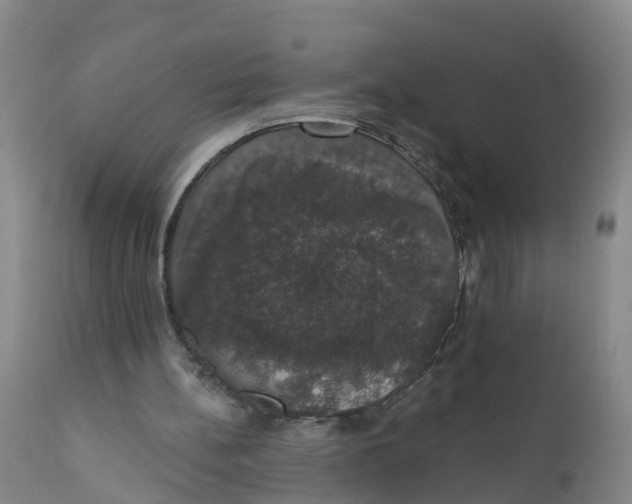 X0000111800148200908131444