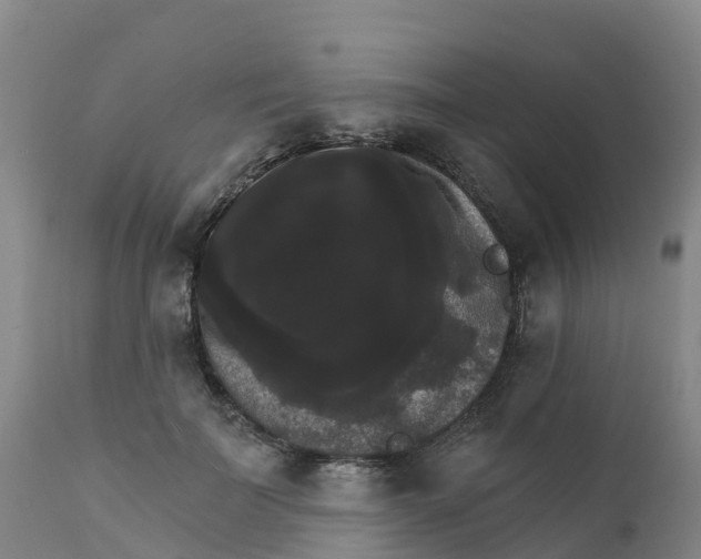 X0000111800699200908131436
