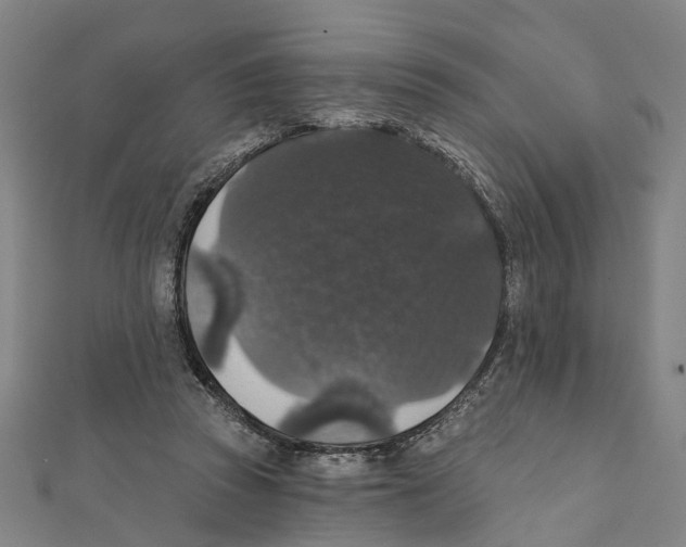 X0000111800353200908201158