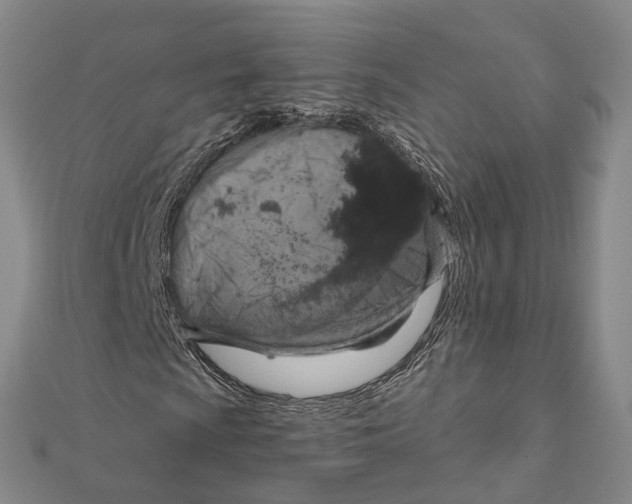 X0000111801009200908201149