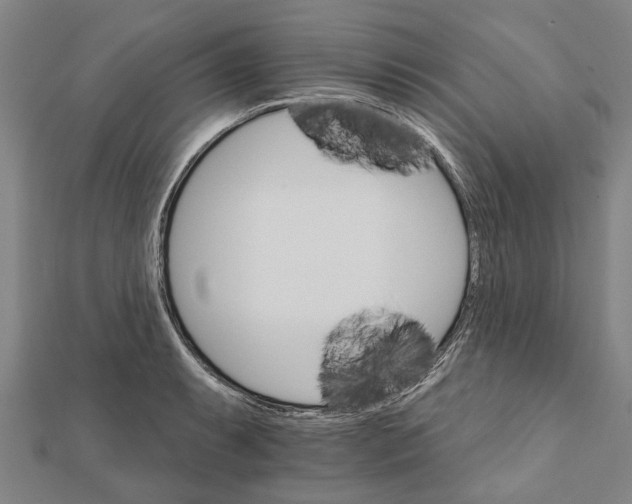 X0000111801087200908201148