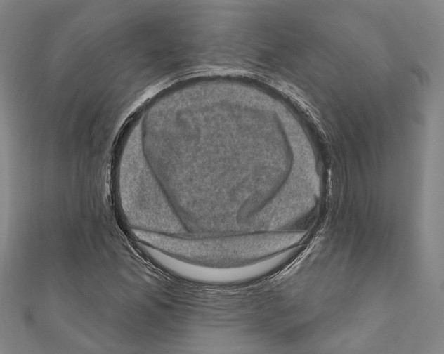 X0000111801165200908201147
