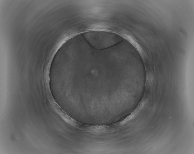 X0000111801435200908201143