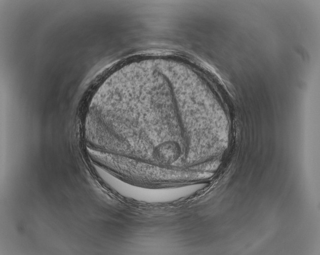 X0000111801448200908201143