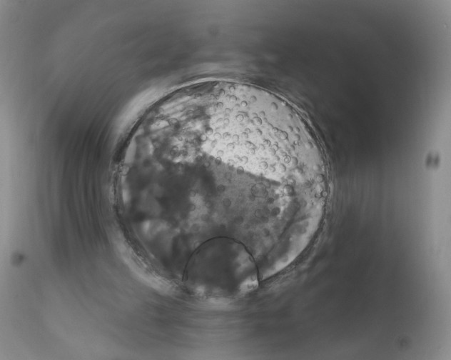 X0000111800149200909031237