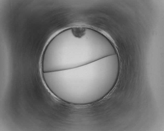 X0000111811440200907231007