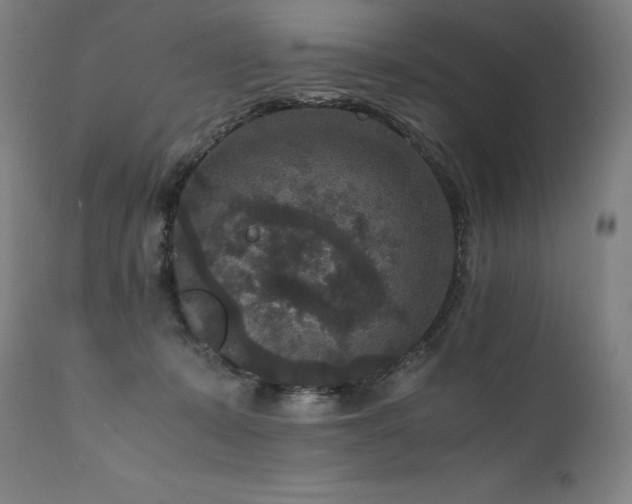 X0000111810319200907231240