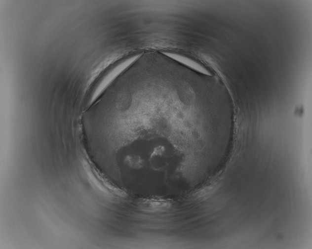 X0000111810443200907301237