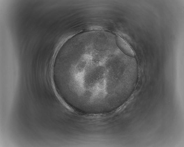 X0000111810049200908061123